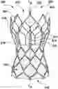 Fig. 01 - Transcatheter heart valve prostheses
