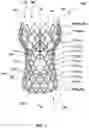 Fig. 02 - Transcatheter heart valve prostheses