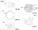 Fig. 12 - Transcatheter heart valve prostheses