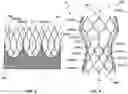 Fig. 16 - Transcatheter heart valve prostheses
