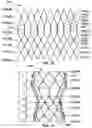 Fig. 17 - Transcatheter heart valve prostheses