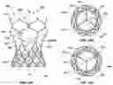 Fig. 18 - Transcatheter heart valve prostheses