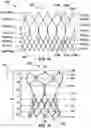 Fig. 20 - Transcatheter heart valve prostheses