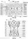 Fig. 23 - Transcatheter heart valve prostheses