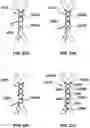 Fig. 25 - Transcatheter heart valve prostheses