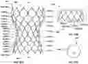 Fig. 30 - Transcatheter heart valve prostheses