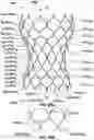Fig. 32 - Transcatheter heart valve prostheses