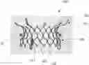 Fig. 01 - FLARED PROSTHETIC CARDIAC VALVE DELIVERY DEVICES AND SYSTEMS