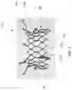 Fig. 03 - FLARED PROSTHETIC CARDIAC VALVE DELIVERY DEVICES AND SYSTEMS