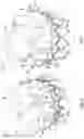 Fig. 06 - FLARED PROSTHETIC CARDIAC VALVE DELIVERY DEVICES AND SYSTEMS