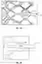 Fig. 12 - FLARED PROSTHETIC CARDIAC VALVE DELIVERY DEVICES AND SYSTEMS