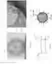 Fig. 17 - FLARED PROSTHETIC CARDIAC VALVE DELIVERY DEVICES AND SYSTEMS