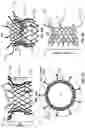 Fig. 20 - FLARED PROSTHETIC CARDIAC VALVE DELIVERY DEVICES AND SYSTEMS