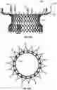 Fig. 26 - FLARED PROSTHETIC CARDIAC VALVE DELIVERY DEVICES AND SYSTEMS
