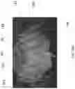 Fig. 27 - FLARED PROSTHETIC CARDIAC VALVE DELIVERY DEVICES AND SYSTEMS