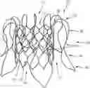 Fig. 01 - STENT DEVICE FOR A PROSTHETIC HEART VALVE