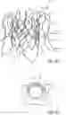 Fig. 04 - STENT DEVICE FOR A PROSTHETIC HEART VALVE
