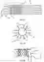 Fig. 08 - STENT DEVICE FOR A PROSTHETIC HEART VALVE