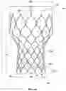 Fig. 06 - Transcatheter heart valve prosthesis systems and methods for rotational alignment