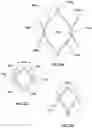 Fig. 07 - Transcatheter heart valve prosthesis systems and methods for rotational alignment