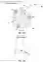 Fig. 21 - Transcatheter heart valve prosthesis systems and methods for rotational alignment