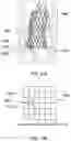 Fig. 23 - Transcatheter heart valve prosthesis systems and methods for rotational alignment
