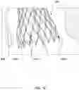 Fig. 25 - Transcatheter heart valve prosthesis systems and methods for rotational alignment