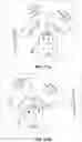 Fig. 40 - Transcatheter heart valve prosthesis systems and methods for rotational alignment