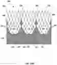 Fig. 44 - Transcatheter heart valve prosthesis systems and methods for rotational alignment
