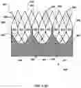 Fig. 46 - Transcatheter heart valve prosthesis systems and methods for rotational alignment