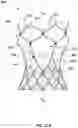 Fig. 47 - Transcatheter heart valve prosthesis systems and methods for rotational alignment