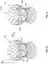 Fig. 51 - Transcatheter heart valve prosthesis systems and methods for rotational alignment