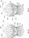 Fig. 52 - Transcatheter heart valve prosthesis systems and methods for rotational alignment