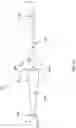 Fig. 08 - DELIVERY SYSTEMS FOR PROSTHETIC HEART VALVES
