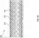 Fig. 15 - DELIVERY SYSTEMS FOR PROSTHETIC HEART VALVES