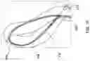 Fig. 21 - DELIVERY SYSTEMS FOR PROSTHETIC HEART VALVES