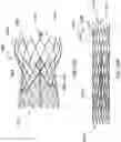 Fig. 25 - DELIVERY SYSTEMS FOR PROSTHETIC HEART VALVES