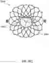 Fig. 26 - DELIVERY SYSTEMS FOR PROSTHETIC HEART VALVES