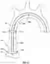 Fig. 09 - Delivery system having an integral centering mechanism for positioning a valve prosthesis in situ