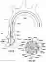 Fig. 12 - Delivery system having an integral centering mechanism for positioning a valve prosthesis in situ