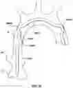 Fig. 16 - Delivery system having an integral centering mechanism for positioning a valve prosthesis in situ