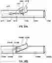 Fig. 21 - Delivery system having an integral centering mechanism for positioning a valve prosthesis in situ