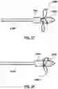Fig. 24 - Delivery system having an integral centering mechanism for positioning a valve prosthesis in situ