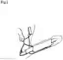 Fig. 02 - Grayson Bionic Penis (GBP)