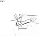 Fig. 03 - Grayson Bionic Penis (GBP)