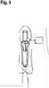 Fig. 07 - Grayson Bionic Penis (GBP)