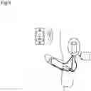 Fig. 10 - Grayson Bionic Penis (GBP)