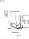 Fig. 11 - Grayson Bionic Penis (GBP)