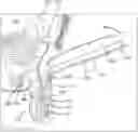Fig. 01 - INFLATABLE PENILE PROSTHESIS WITH VALVES FOR INCREASING FLOW EFFICIENCY