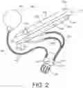 Fig. 03 - INFLATABLE PENILE PROSTHESIS WITH VALVES FOR INCREASING FLOW EFFICIENCY
